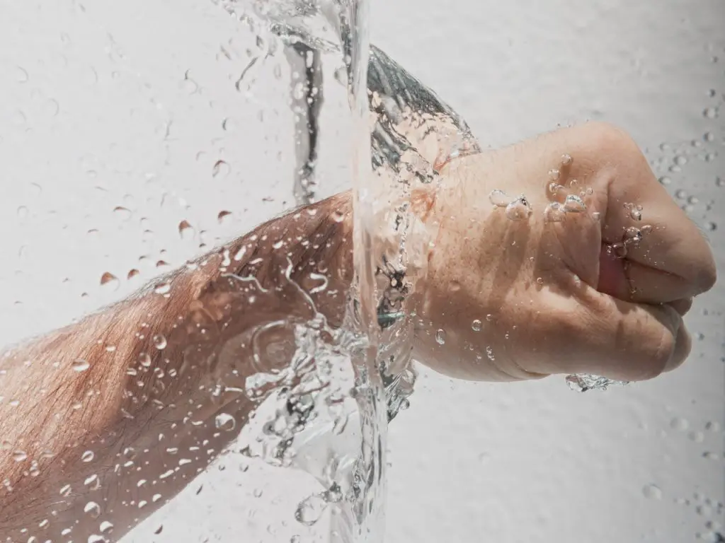 hyperhidrosis hands